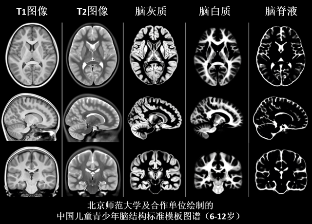 6北师大及合作单位绘制的中国儿童青少年脑结构标准模板图谱.png