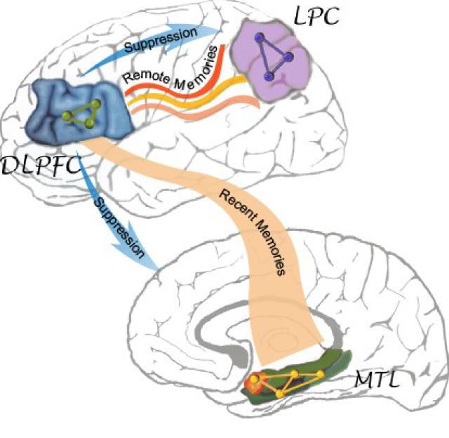 8大脑对负面情绪信息的记忆经过睡眠固化后，会变得更加难于“被驾驭和抑制”.jpg